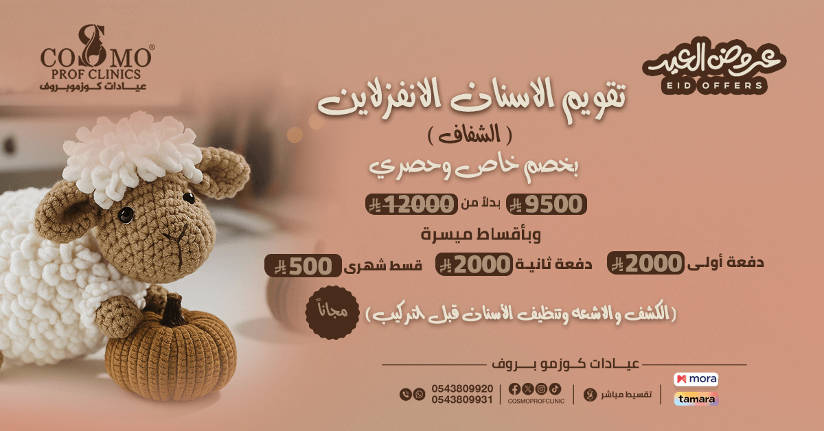 تقويم اسنان