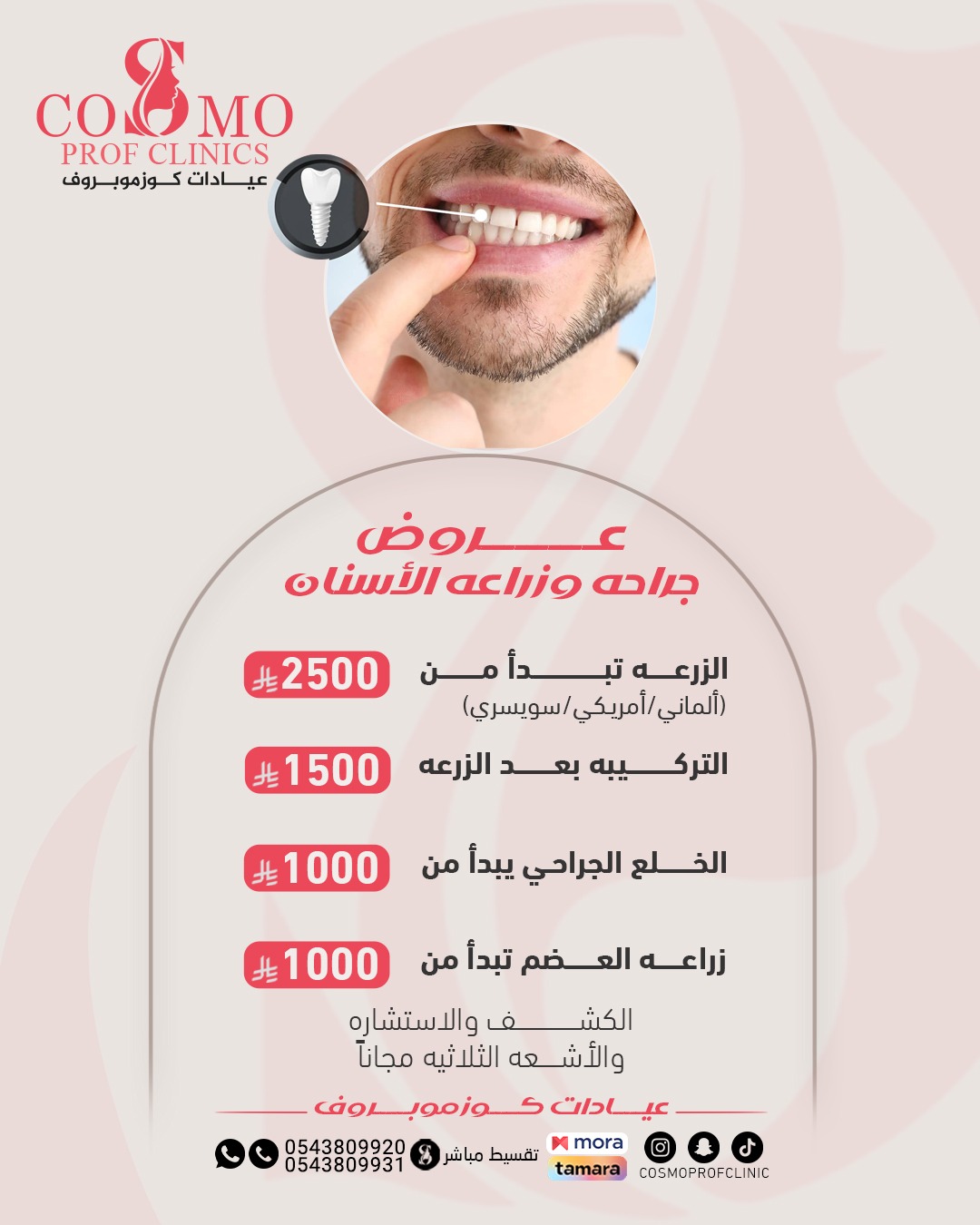 زراعة الاسنان