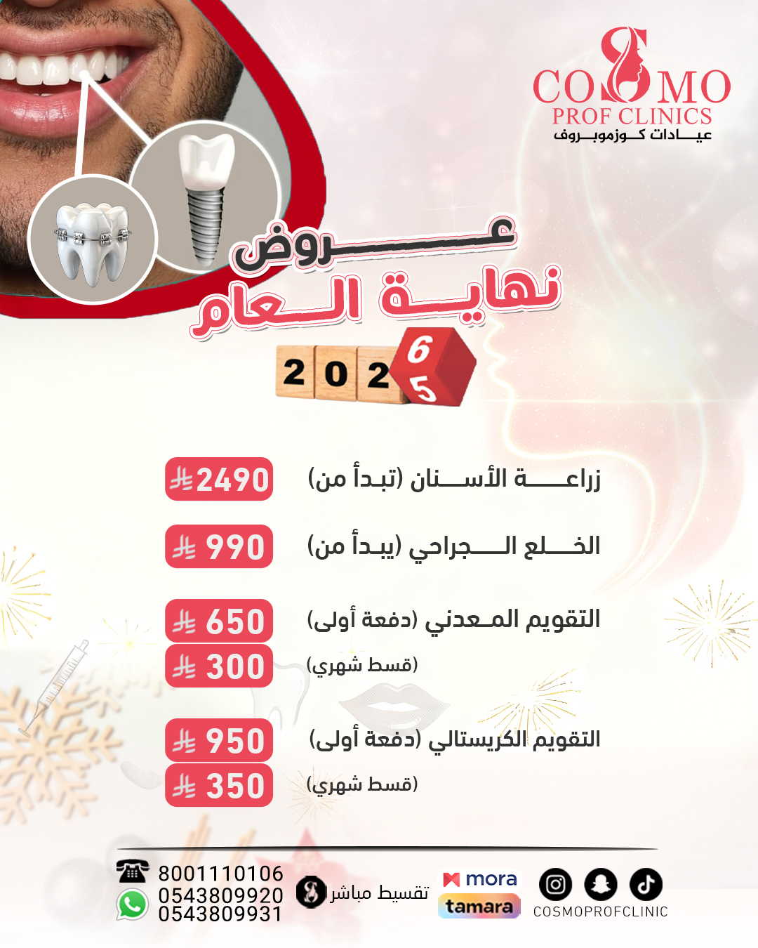 زراعة الاسنان